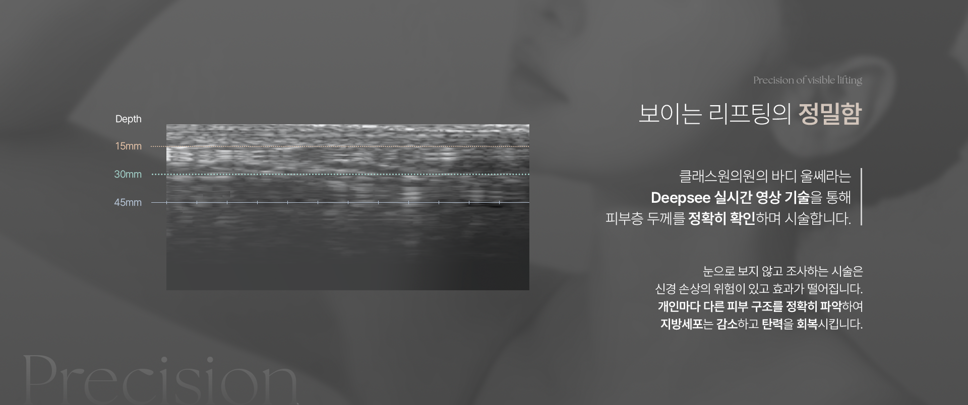 Precision of visible lifting 보이는 리프팅의 정밀함. 클래스원의원의 바디 울쎄라는 Deepsee 실시간 영상 기술을 통해 피부층 두께를 정확히 확인하며 시술합니다. 눈으로 보지 않고 조사하는 시술은 신경 손상의 위험이 있고 효과가 떨어집니다. 개인마다 다른 피부 구조를 정확히 파악하여 지방세포는 감소하고 탄력을 회복시킵니다.