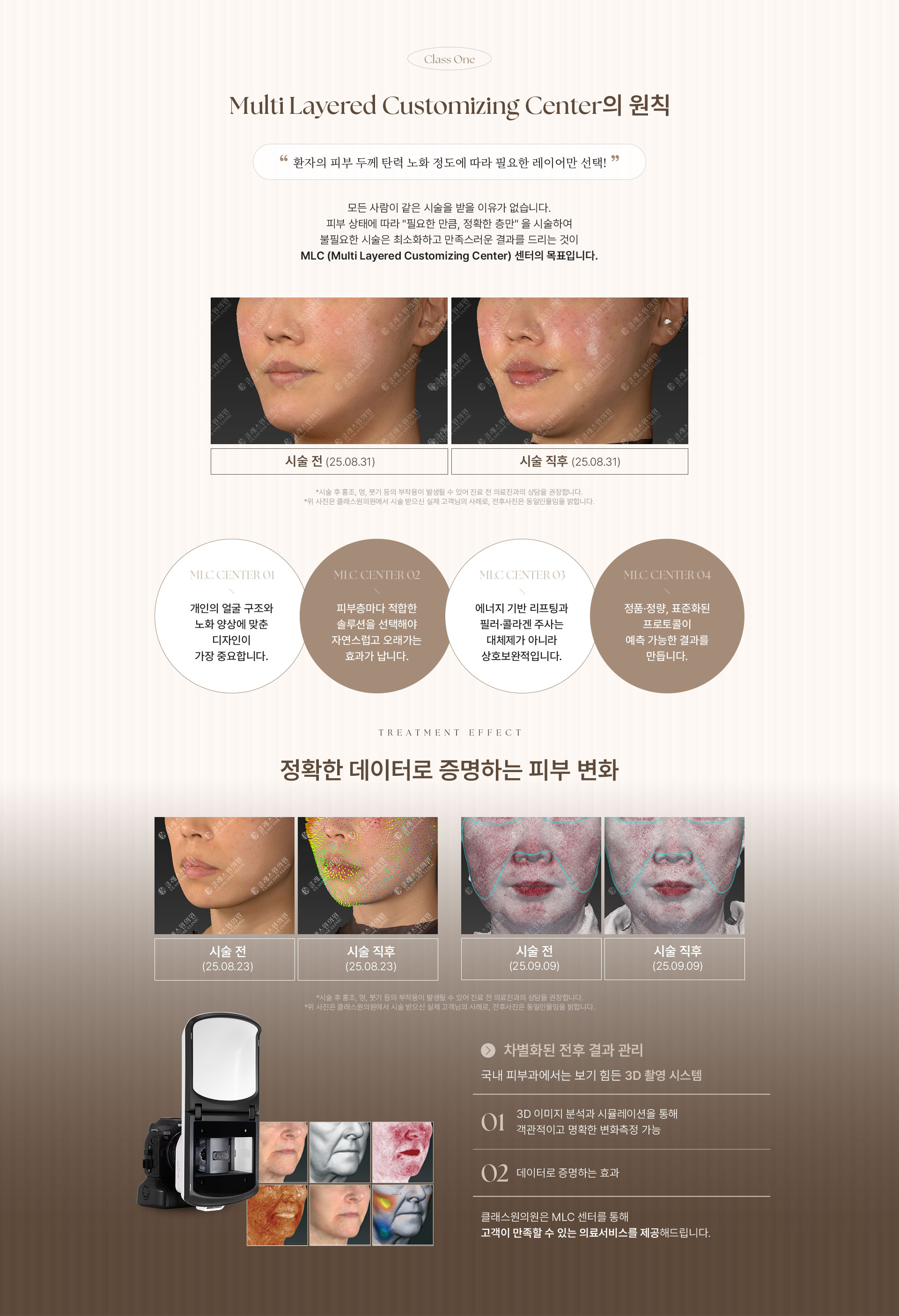 Class One. Multi Layered Customizing Center의 원칙. “환자의 피부 두께 탄력 노화 정도에 따라 필요한 레이어만 선택!” 모든 사람이 같은 시술을 받을 이유가 없습니다. 피부 상태에 따라 “필요한 만큼, 정확한 층만” 을 시술하여 불피요한 시술은 최소화하고 만족스러운 결과를 드리는 것이 MLC (Multi Layered Customizing Center) 센터의 목표 입니다. 시술 케이스는 시술 전(25.08.31), 시술직후 (25.08.31) 비교 이미지 입니다. *시술 후 홍조, 멍, 붓기 등의 부작용이 발생할 수 있어 진료 전 의료진과의 상담을 권장합니다. *위 사진은 클래스원의원에서 시술 받으신 실제 고객님의 사례로, 전후사진은 동일인물임을 밝힙니다. MLC Center 01:개인의 얼굴 구조와 노화 양상에 맞춘 디자인이 가장 중요합니다. MLC Center 02:피부층마다 적합한 솔루션을 선택해야 오래가는 효과가 나타납니다. MLC Center 03:에너지 기반 리프팅과 필러·콜라겐 주사는 대체제가 아니라 상호보완적입니다. MLC Center 04:정품·정량,표준화된 프로토콜이 예층 가능한 결과를 만듭니다. TREATMENT EFFECT 정확한 데이터로 증명하는 피부 변화. 시술 케이스 중 첫번째는 시술 전(25.08.23), 시술직후 (25.08.23) 비교 이미지 입니다. 시술 케이스 중 두번째는 시술 전(25.09.09), 시술직후 (25.09.09) 비교 이미지 입니다. *시술 후 홍조, 멍, 붓기 등의 부작용이 발생할 수 있어 진료 전 의료진과의 상담을 권장합니다. *위 사진은 클래스원의원에서 시술 받으신 실제 고객님의 사례로, 전후사진은 동일인물임을 밝힙니다. 차별화된 전후 결과 관리. 국내 피부과에서는 보기 힘든 3D 촬영 시스템. 01) 3D 이미지 분석과 시뮬레이션을 통해 객관적이고 명확한 변화측정 가능. 02) 데이터로 증명하는 효과. 클래스원의원은 MLC 센터를 통해 고객이 만족할 수 있는 의료서비스를 제공해드립니다.