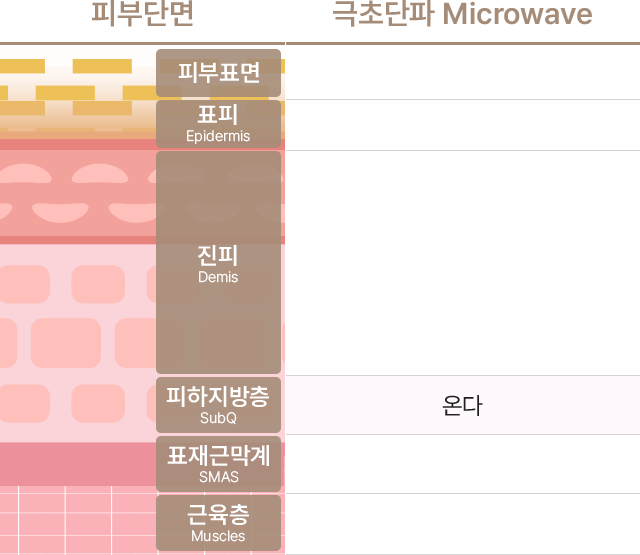 극초단파 Microwave의 종류에는 온다가 있으며 피부단면의 피부표면,표피(Epidermis),진피(Demis),피하지방층(SubQ),표재근막계(SMAS),근육층(Muscles) 중에서 피하지방층(SubQ)에 도달합니다.
