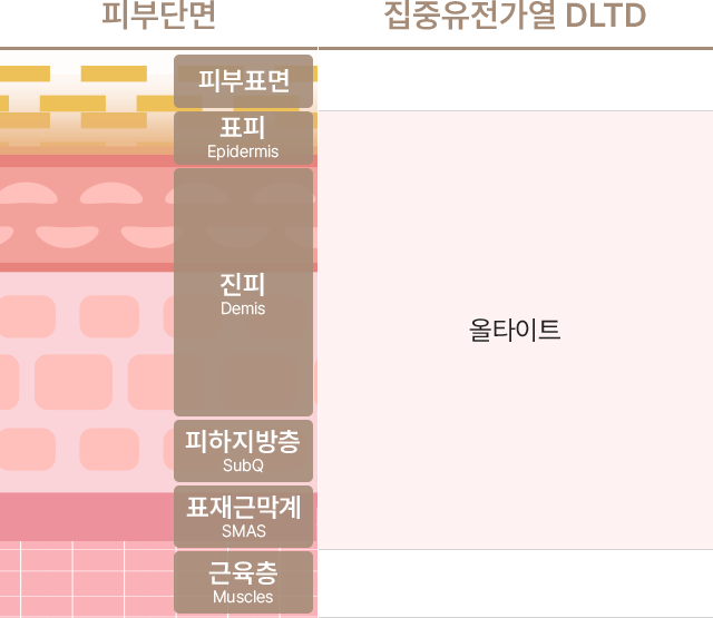 집중유전가열 DLTD의 종류에는 올타이트가 있으며 피부단면의 피부표면,표피(Epidermis),진피(Demis),피하지방층(SubQ),표재근막계(SMAS),근육층(Muscles) 중에서 표피(Epidermis),진피(Demis),피하지방층(SubQ),표재근막계(SMAS)에 도달합니다.